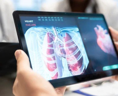 Pneumotórax e cirurgia: quando o tratamento vai além do dreno e o que esperar do procedimento